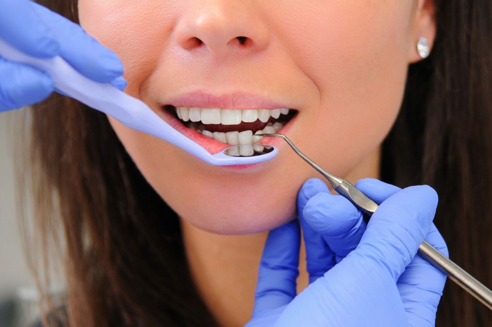 Полость рта для стоматолога. Пародонтология стоматология. Стоматологические заболевания. Зубы стоматология.